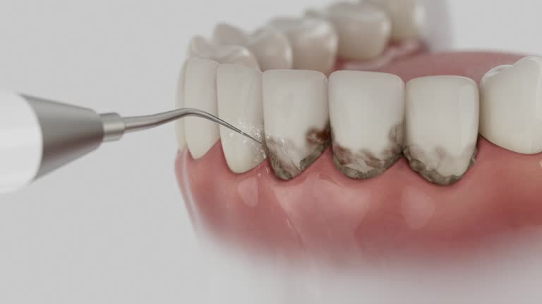 Trusted Teeth Cleaning And Checkup service in Powdersville, SC - Dentist Open Now